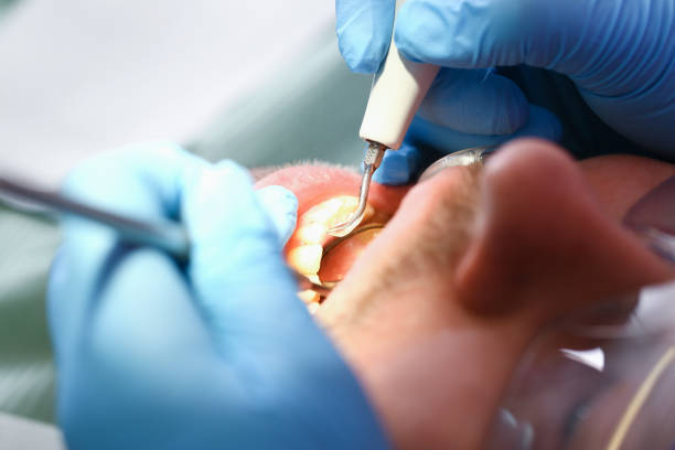 Best Walk-In Emergency Dentist in Menasha, WI