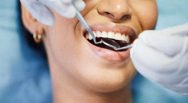 Best Emergency Treatment for Toothache in Menasha, WI